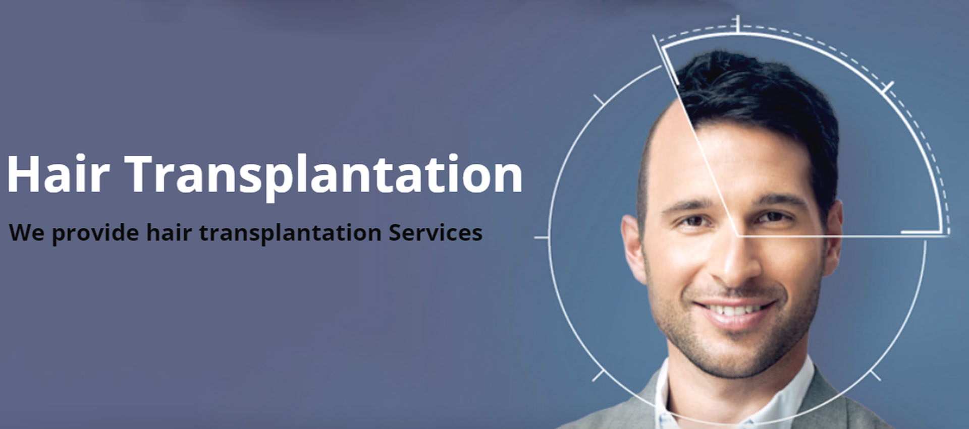 expretzhair transplantation treatment